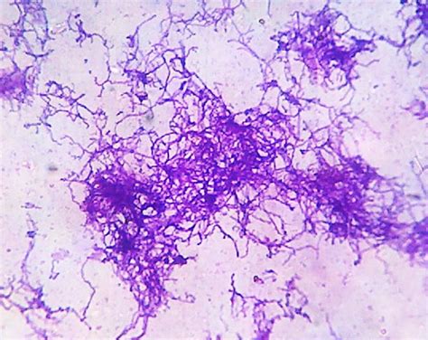 Grams Staining Showing Long Filamentous Branched Gram