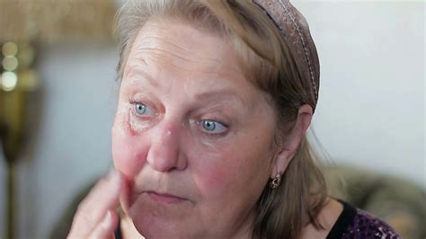 Elderly Woman Applying Face Cream Against Skin Redness Or Rejuvenating