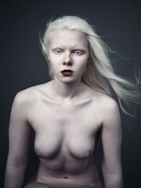 Albino Girl Nude Datawav