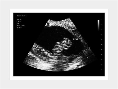 8 Weeks Fake Ultrasound W Instant Download