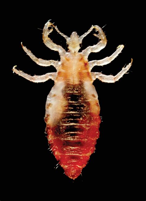 Head Lice Under Microscope
