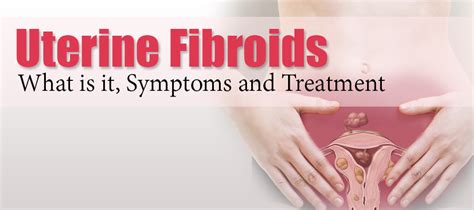 Uterine Fibroids What Is It Symptoms And Treatment Uterine Fibroids