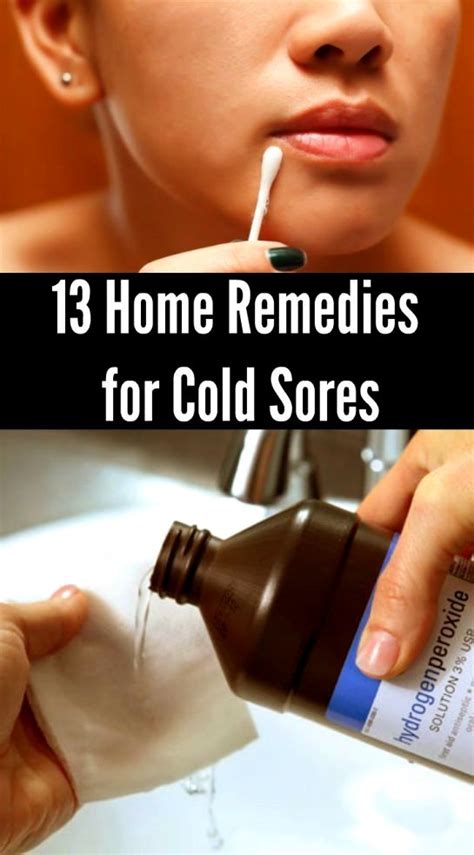 Cold Sore Medicine In 2020 Cold Home Remedies Cold Sores Remedies