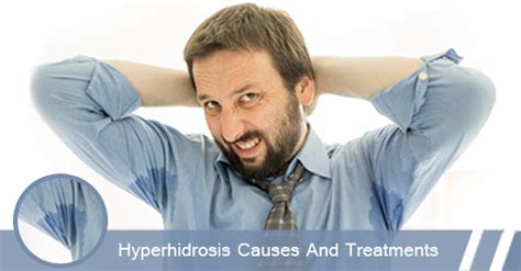 Causes And Treatments Of Hyperhidrosis Centre For Dermatology