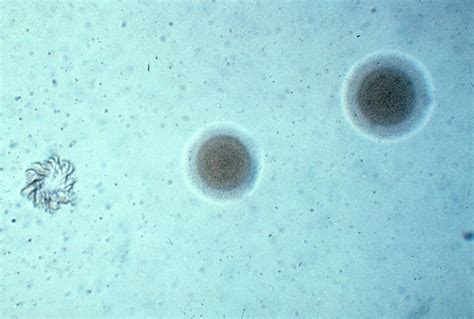 B642 4 Mycoplasma Pneumoniae Photomicrograph Unstained Flickr