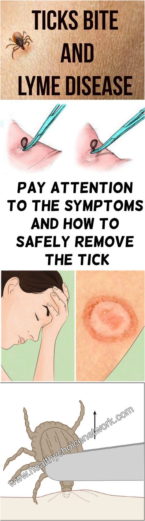 Ticks Bite And Lyme Disease Pay Attention To The Symptoms And How To