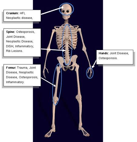 This article contains a list of human body parts names. Impact of industrialisation on London health | Museum of London