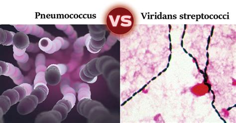 Pneumococcus Vs Viridans Streptococci 12 Major Differences