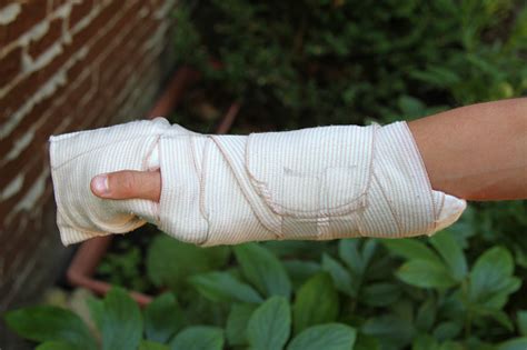Arm Wrapped Up In A Bandage Stock Photo Download Image Now Istock