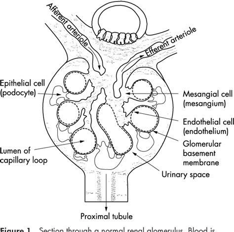 Figure 1 From Acute Glomerulonephritis C Semantic Scholar