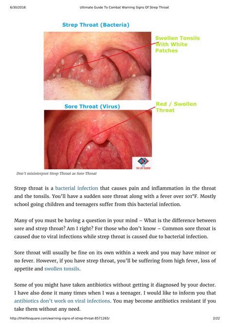 Ppt Ultimate Guide To Combat Warning Signs Of Strep Throat Powerpoint