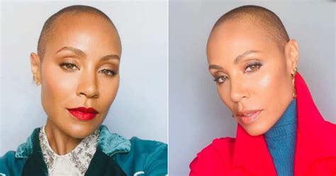 Alopecia Actress Jada Pinkett Smith Gets Candid About Difficult Hair