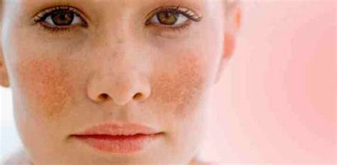 Best Home Remedies For Glowing Skin Reliablerxpharmacy