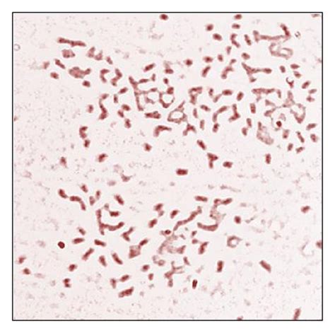 Grams Staining Showing Gram Negative Rods Of Isolated Pseudomonas