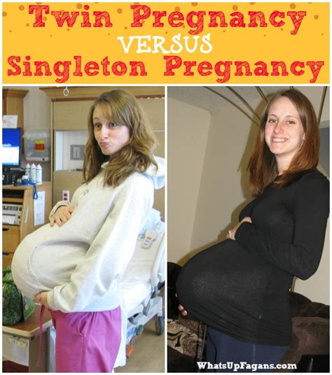 Twin Pregnancy Vs Singleton Pregnancy