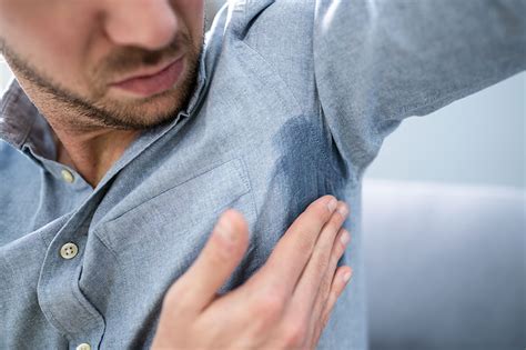 Symptoms Types And Management Options Of Hyperhidrosis
