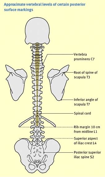 Spinal Landmarks Radiology Student Anatomy Scapula