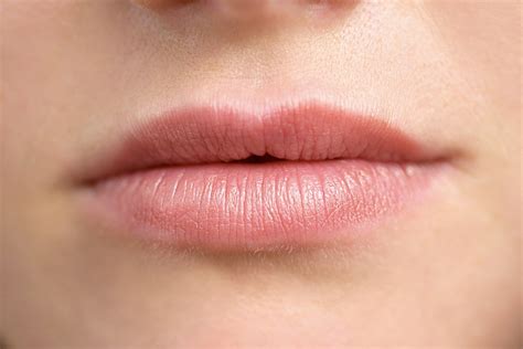Staph Infection Chapped Lips Lipstutorial Org