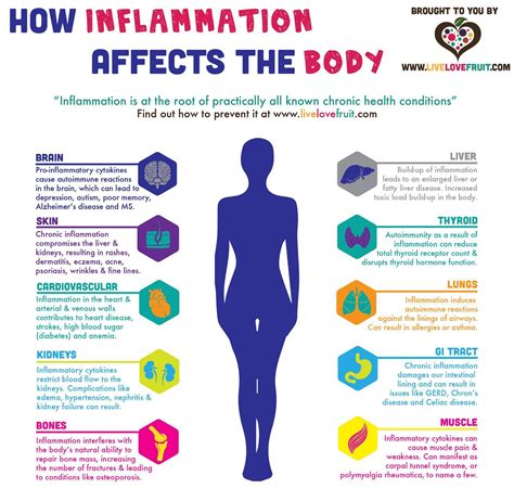 Low Grade Inflammation And Musculoskeletal Diseases Sol Wellness Llc