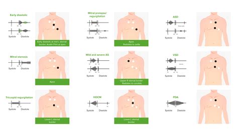Aortic Regurgitation Concise Medical Knowledge