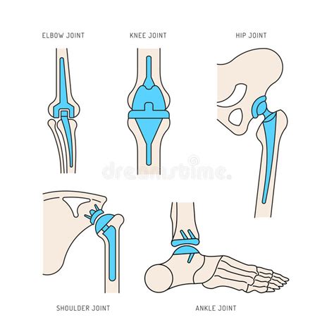 How many major joints are in the human body. Implantation Joint Skeleton Stock Image - Image of ...