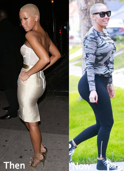 Amber Rose Butt Implant Rumors Latest Plastic Surgery Gossip And News Plastic Surgery Tips