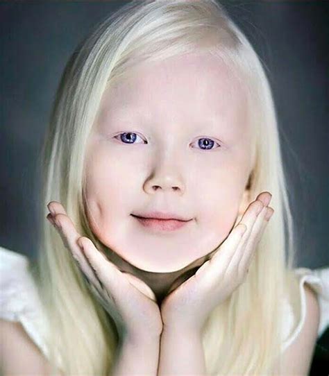 8 Yr Old Albino Girls Stunning Looks Have Modeling Offers Pouring In