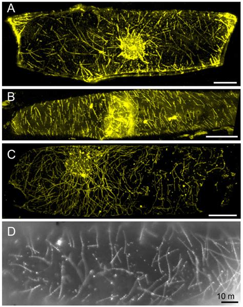 Appearance Of Filamentous Structures Labeled By Myosin Constructs A