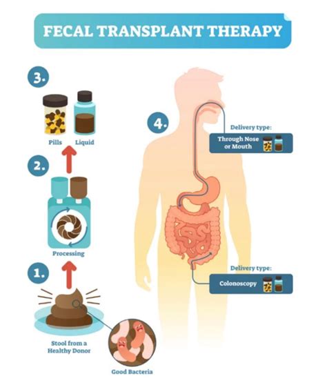 Fecal Transplantation Science S Dirty Secret Omixon