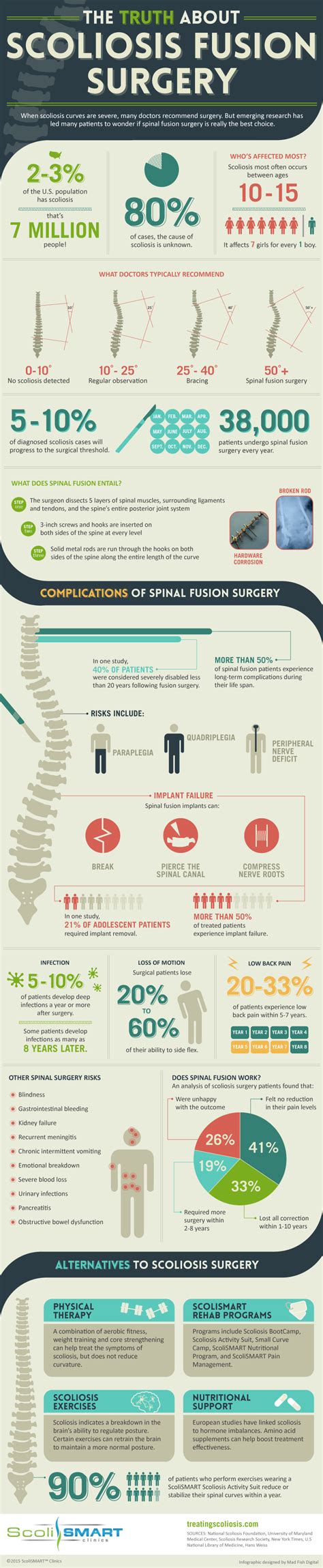 The Truth About Scoliosis Fusion Surgery Scoliosis Scoliosis Surgery