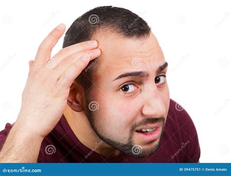 Man Lose His Hair Stock Image Image Of Looking Balding 39475751