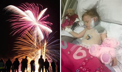 Girl Suffers Burns And Injuries To Her Face After Fireworks Catches On