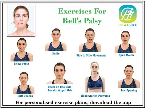 Facial Exercises For Bells Palsy Pictures Exercise Poster