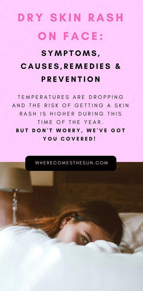 The 25 Best Types Of Rashes Ideas On Pinterest Rash Types Rashes In Images
