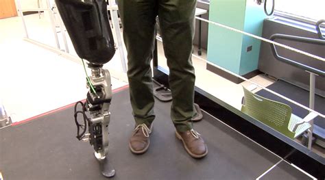 Amputees Discover New Mobility With Bionic Leg Video Medill Reports