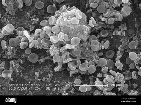 Human Red Blood Cell Electron Microscope Micropedia