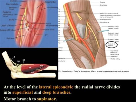 Radial Nerve Injury