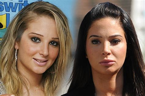 Tulisa Nose Job Plastic Surgery Before And After Photos