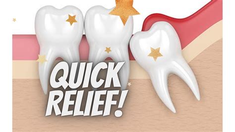 Wisdom Tooth Gum Pain Swelling Pericoronitis Gum Swelling Quick