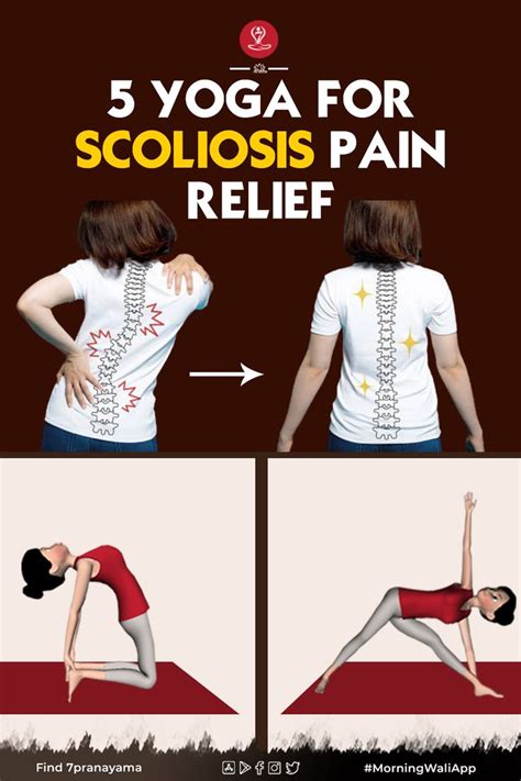 5 Top Scoliosis Exercises Scoliosis Scoliosis Exercises Yoga For Images And Photos Finder