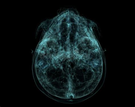 Human Skull Brain By Ct Scan X Ray Visualization Inside Of Skull 3d