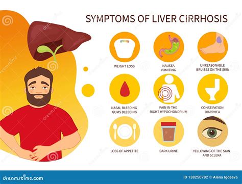 Vector Poster Of Liver Cirrhosis Symptoms Stock Vector Illustration