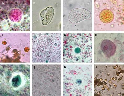 Observed Trophozoites And Cysts Of Protozoa In The Samples Download