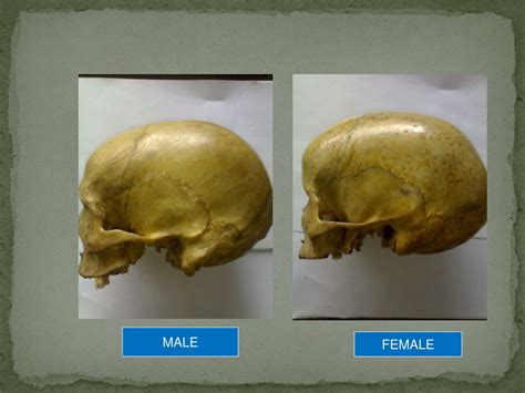 Ppt Sex Determination From Human Skeletal Remains Skull Pelvis Sternum Powerpoint