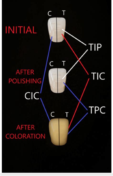 Figure 2 From The Evaluation Of Different Polishing Techniques Effects