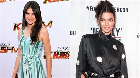 Kendall Jenner Looks Back On Her Ugly Years The Glow
