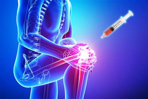 Joint Pain Treatment Ernakulam Osteoarthritis Prp Treatment Kerala India