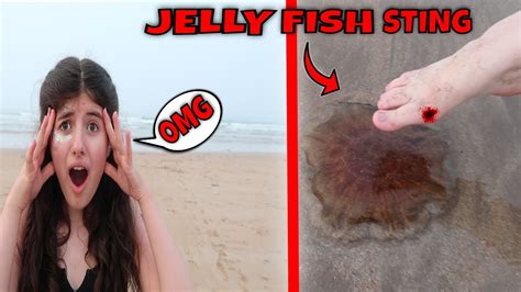 She Got Stung By A Jelly Fish Youtube