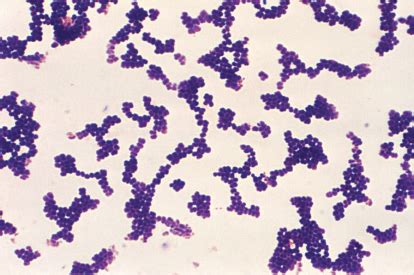 Staphylococcus Aureus Gram
