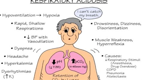 Which includes the nose, pharynx, larynx, and the basic methods of respiratory system examination. Acidosis, Respiratory; Respiratory Acidosis